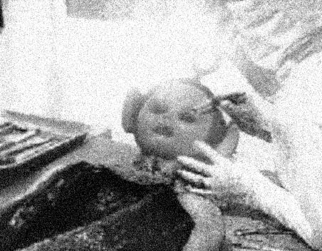 Exposing the lies. This picture shows the REAL alien autopsy!!!